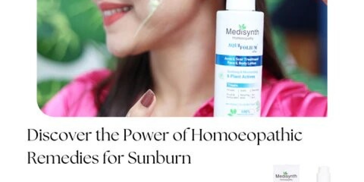 Holistic Sunburn Care: Effective Homeopathy Solutions for Skin Healing