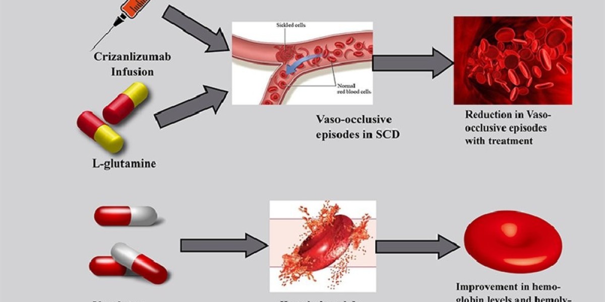 Sickle Cell Disease Treatment Market Growth, Opportunities and Industry Forecast Report 2033