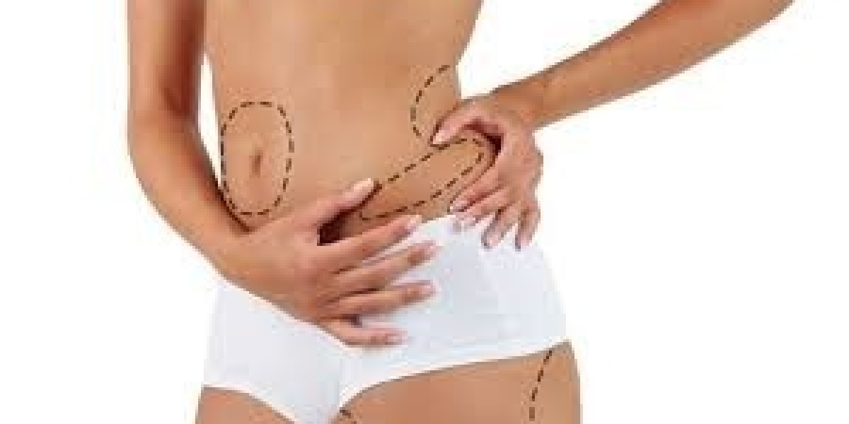 From Consultation to Transformation: Liposuction Surgery in Dubai