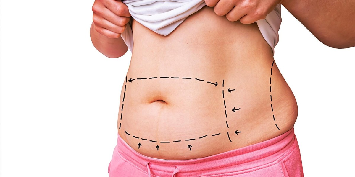 Dubai’s Best Liposuction Surgeons for 2024