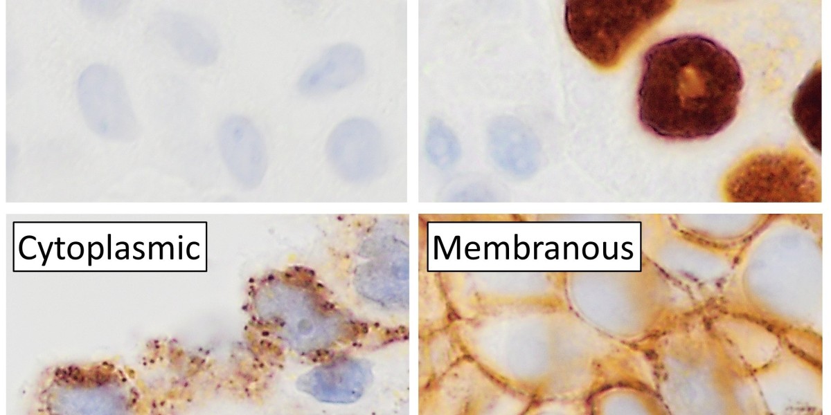 IHC Market Growth Linked to Advances in Cancer Diagnostics