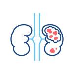 Kidney Cancer