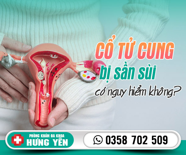 Cổ tử cung bị sần sùi có nguy hiểm không?