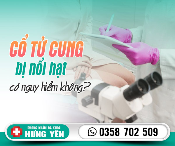 Cổ tử cung bị nổi hạt có sao không? Phải làm sao?