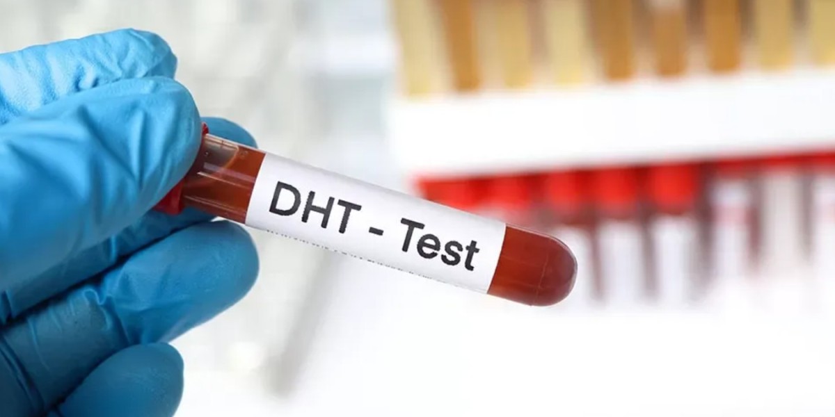 DHT Blood Testing and Hair Loss Treatment