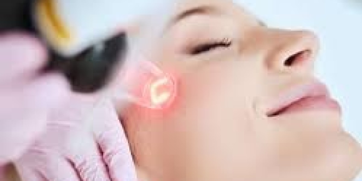 Laser Treatment in Riyadh: Advanced Solutions for Skin, Hair, and Body Concerns