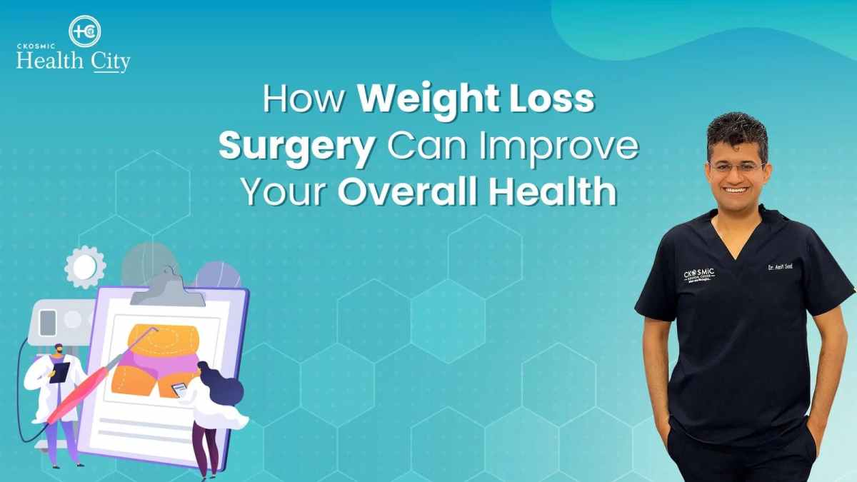 Non-Surgical Weight Loss Options: What Are They? – CKosmic Health City