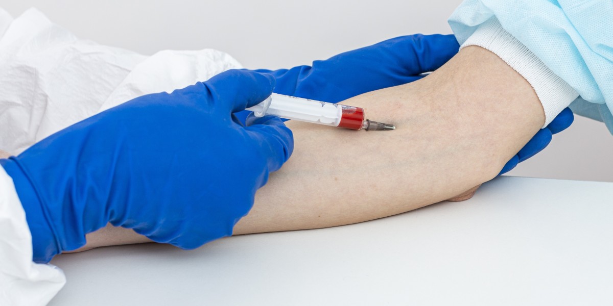 The Role of a Full Blood Count Test in Preventive Healthcare