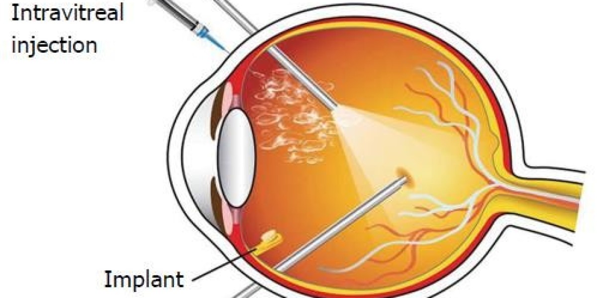 Treatment of Diabetic Macular Edema will grow at highest pace owing to rising prevalence of diabetes