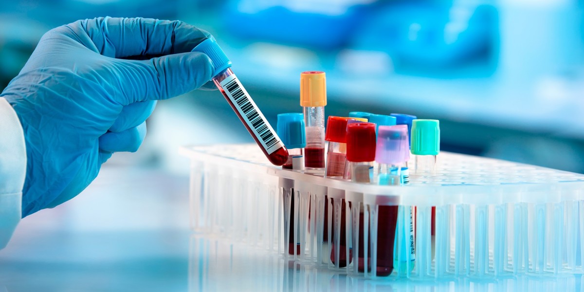 Rare Biological Sample Collection Market Analysis, Size, Share, Growth, Trends, and Forecasts by 2031