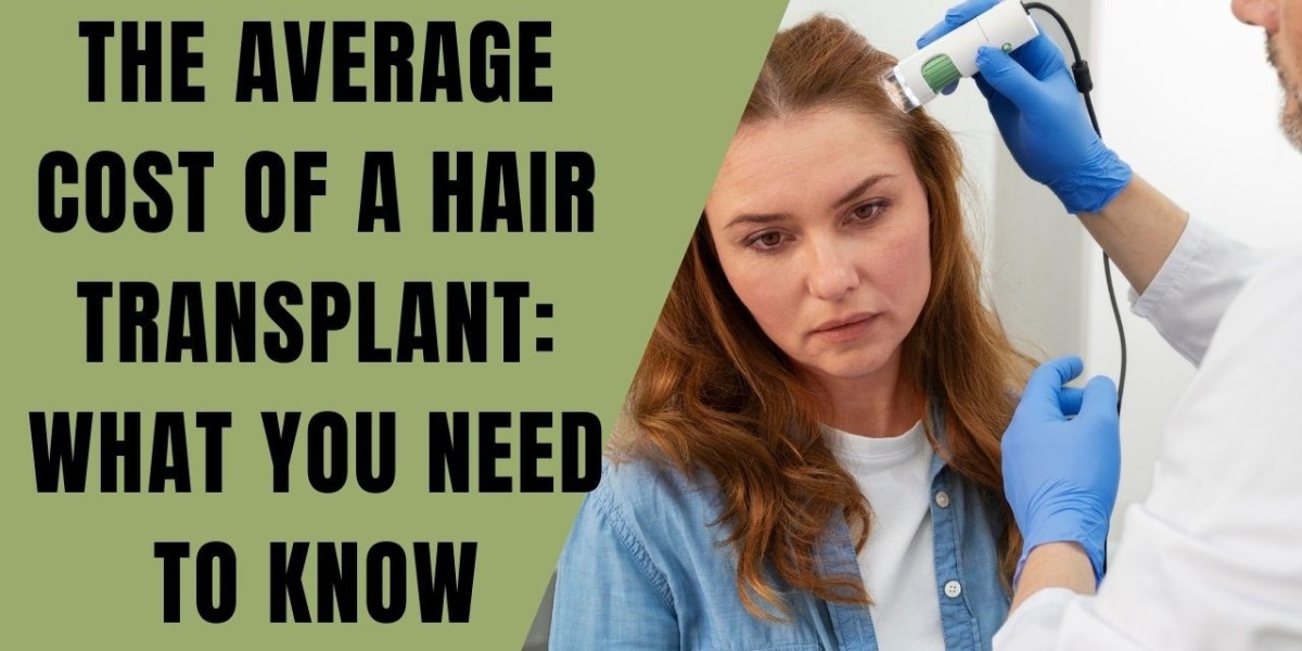 The Average Cost of a Hair Transplant: What You Need to Know