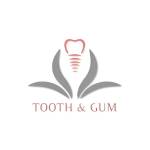 Tooth and Gum