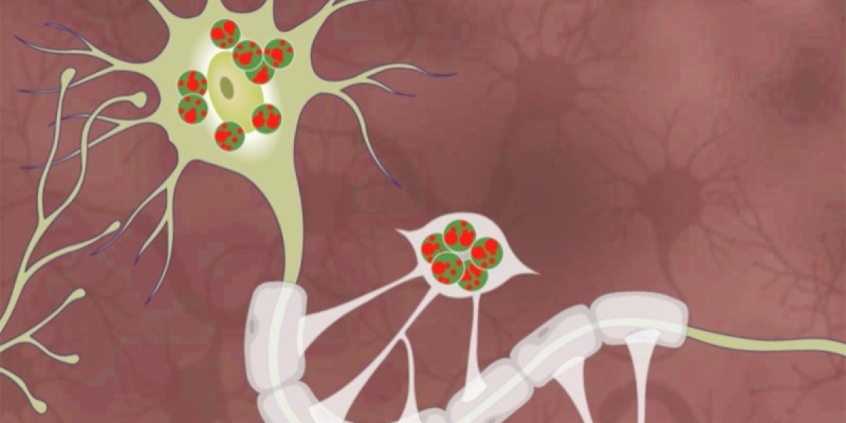 Krabbe Disease Market: Challenges and Opportunities in Drug Development