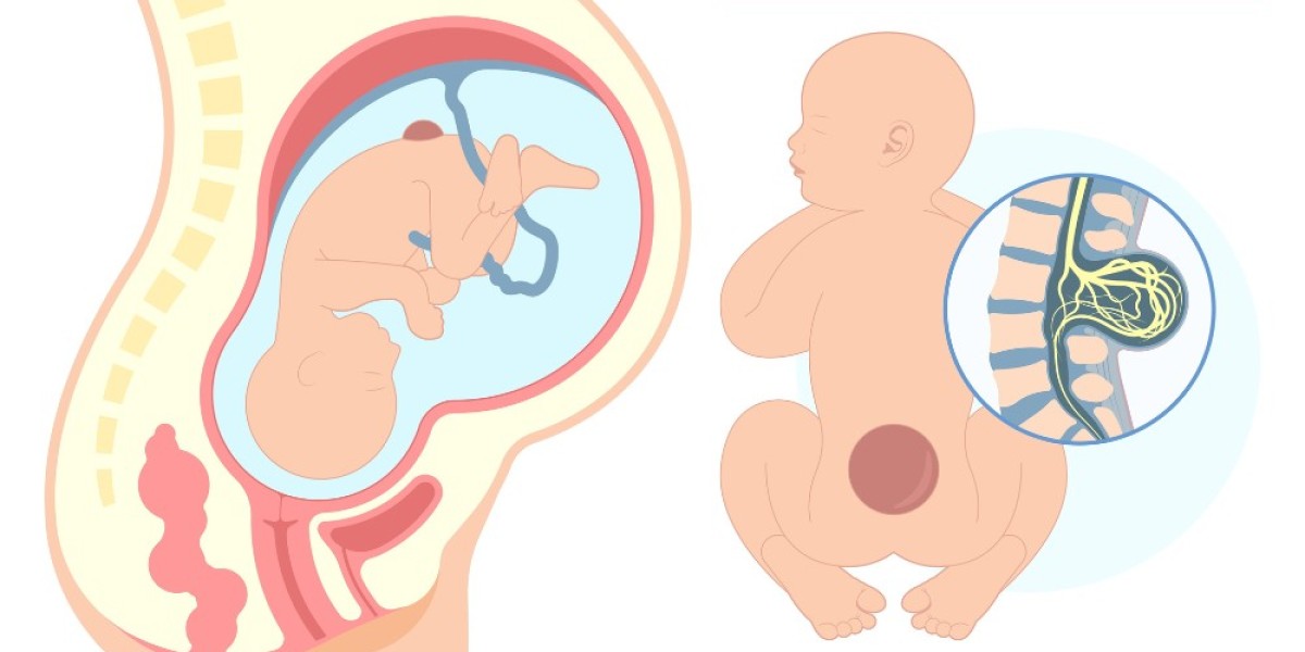 Spina Bifida In-Utero Market Will Grow at Highest Pace Owing to Rising Adoption of Minimally Invasive Surgeries