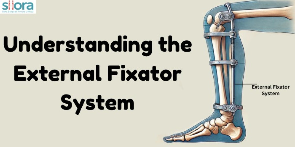 Understanding the External Fixator System: A Comprehensive Guide for Orthopedic Surgeons