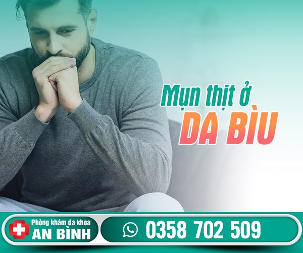 Mụn thịt ở da bìu là bị làm sao? Có nguy hiểm không?