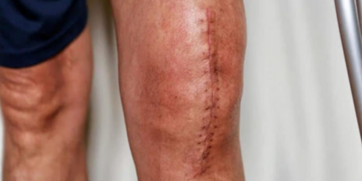 Top 7 Myths About Bone Health Debunked by Orthopedic Specialists in Nagpur