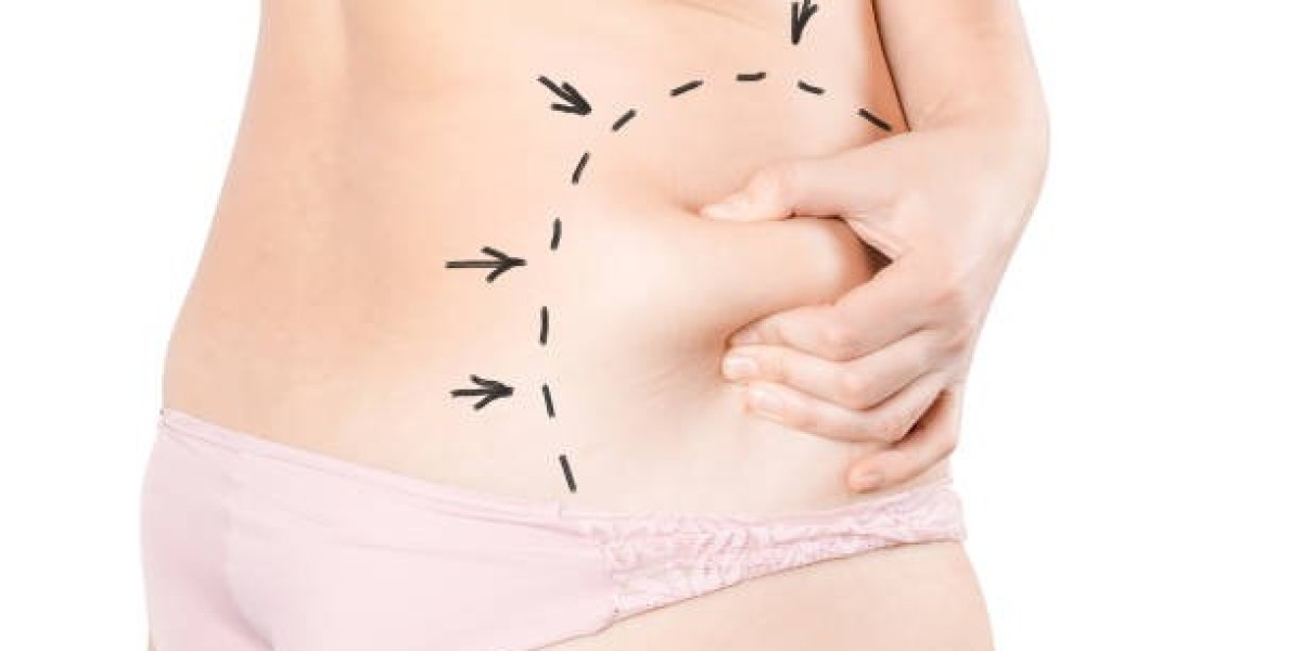 Thigh Lift and Liposuction Riyadh Combination
