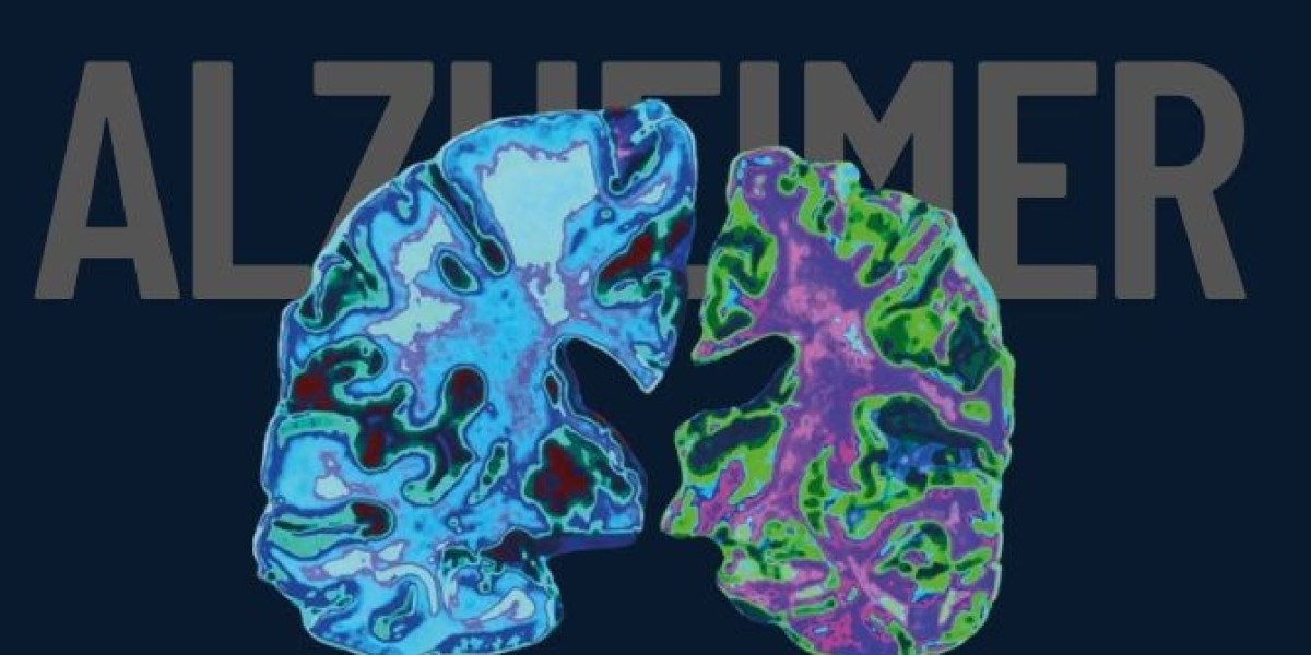 Finding Light in Forgetfulness: Life with Alzheimer’s Disease