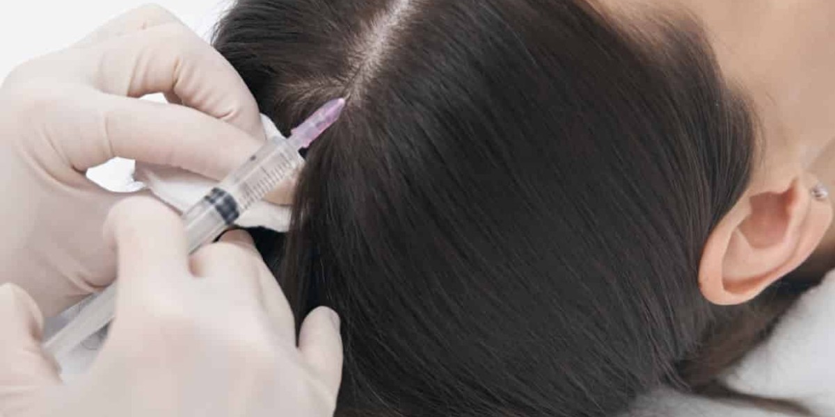 Beyond PRP: Are Exosomes the Next Breakthrough in Hair Restoration?