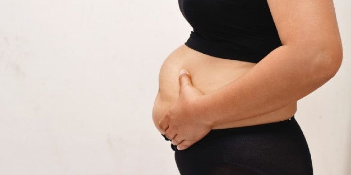 How to Maintain Liposuction Results Long-Term