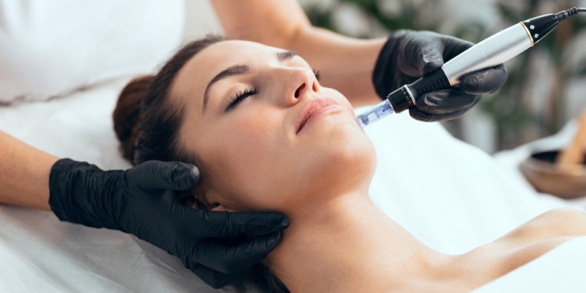 Can Mesotherapy Reverse Thinning Hair?