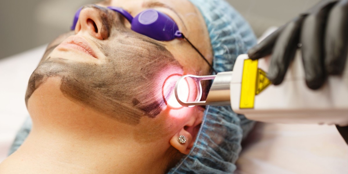 How should I prepare for my PICO Laser session?