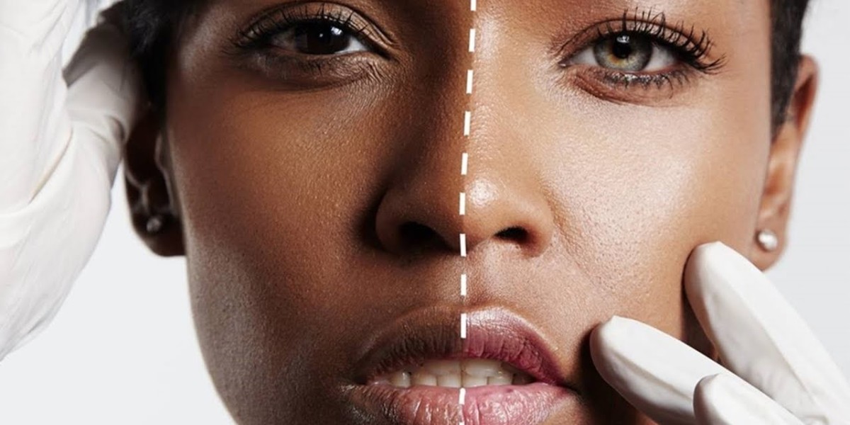 Glutathione Whitening in Islamabad: Injections vs. Drips Explained