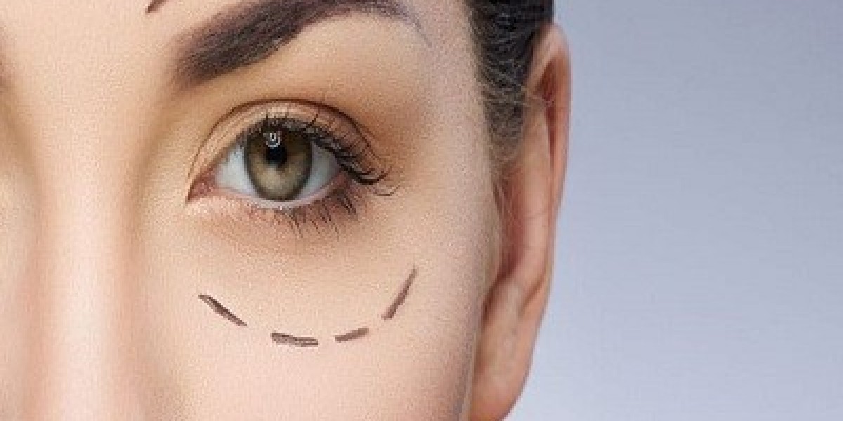 Is Eyelid Surgery in Islamabad Right for You?