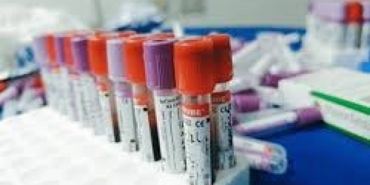 Blood Collection Tubes Market Strategies Analyze Product Differentiation to Capture New Revenue Opportunities
