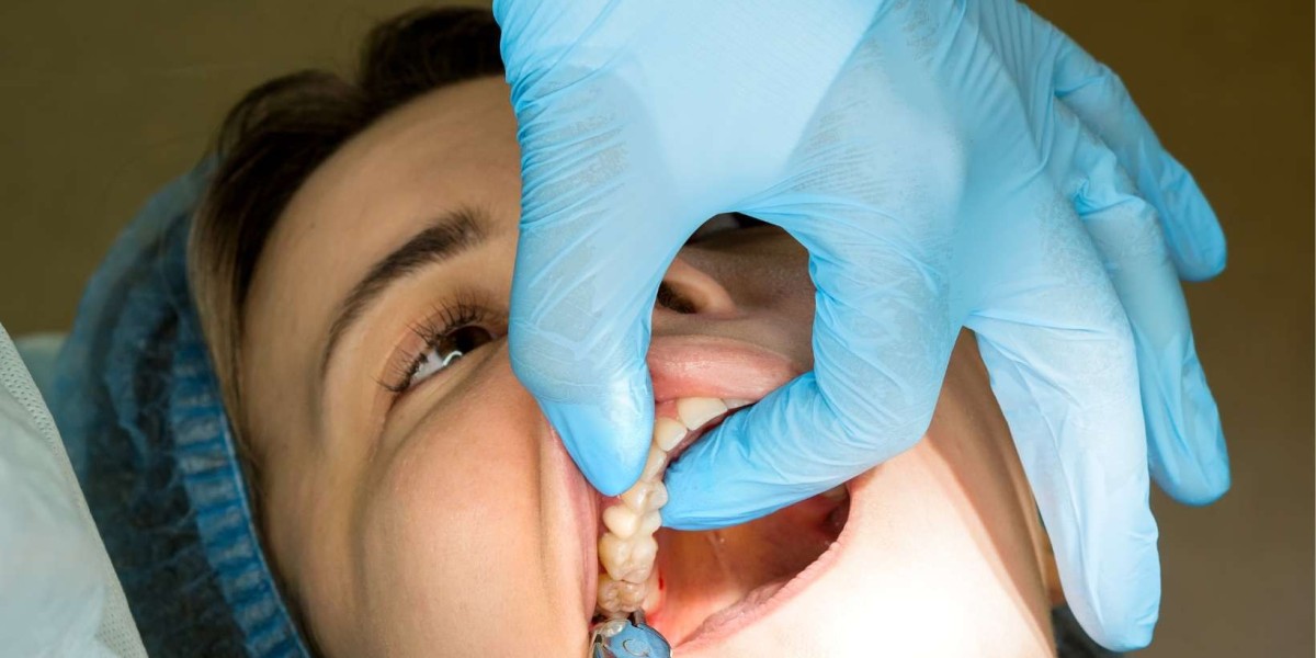 Wisdom Tooth Extraction Recovery: Tips for a Smooth Healing