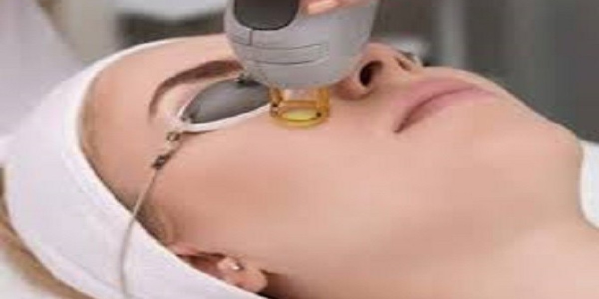 هل إزالة الشعر بالليزر مؤلمة حقًا؟
