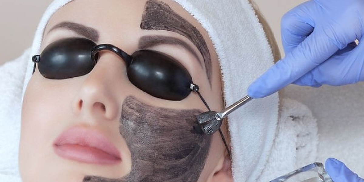What Is the Downtime After Spectra Laser Carbon Peeling?