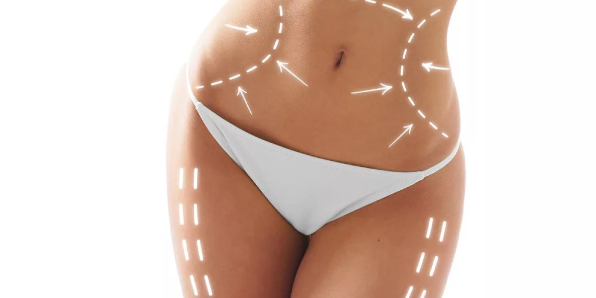 Best Lifestyle Changes to Maintain Liposuction Results in Islamabad