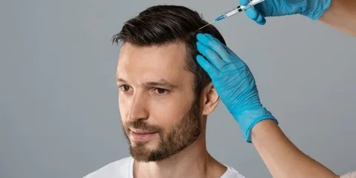 Hair Loss Treatment in Islamabad: Innovative Techniques