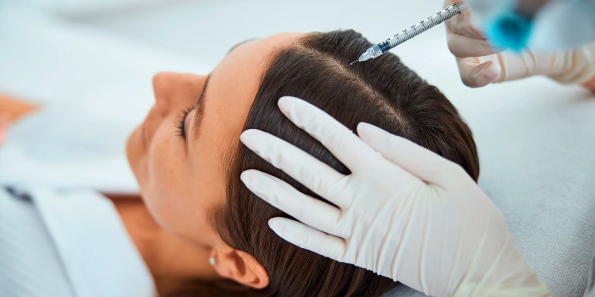 PRP vs. Platelet-Rich Fibrin (PRF): Which One Should You Choose?