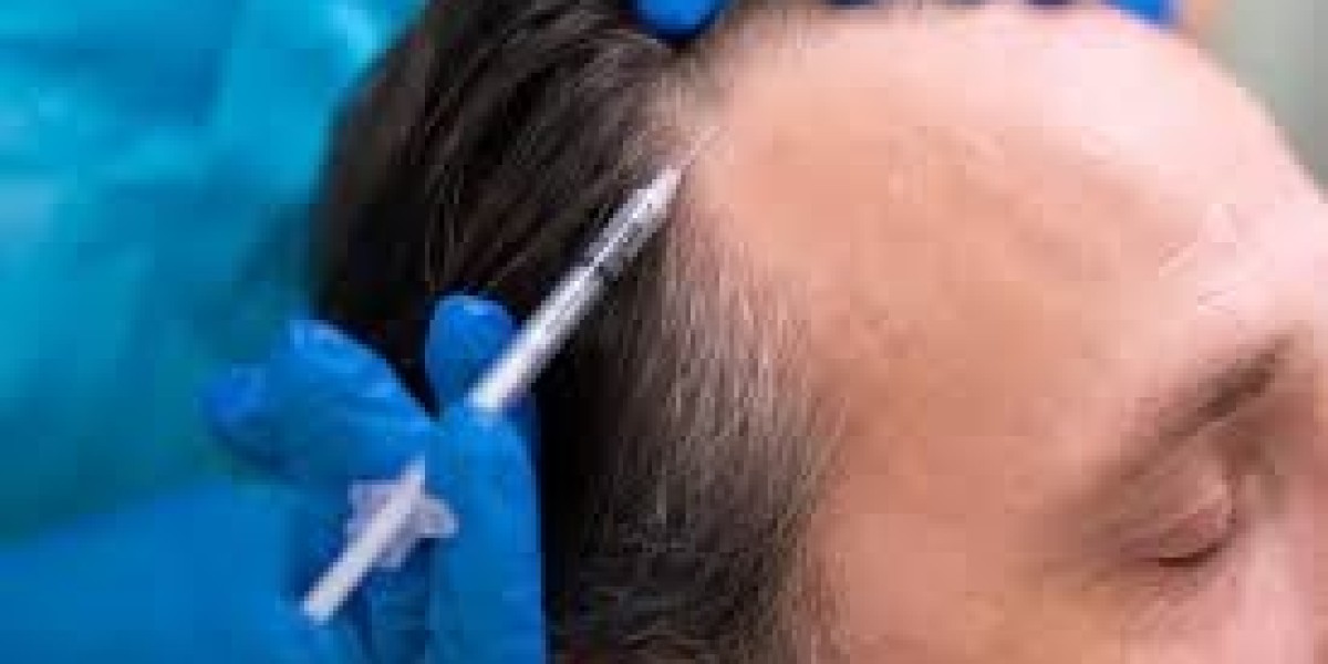 How Surgeons Handle Extremely Curly Hair in Transplants In Dubai UAE