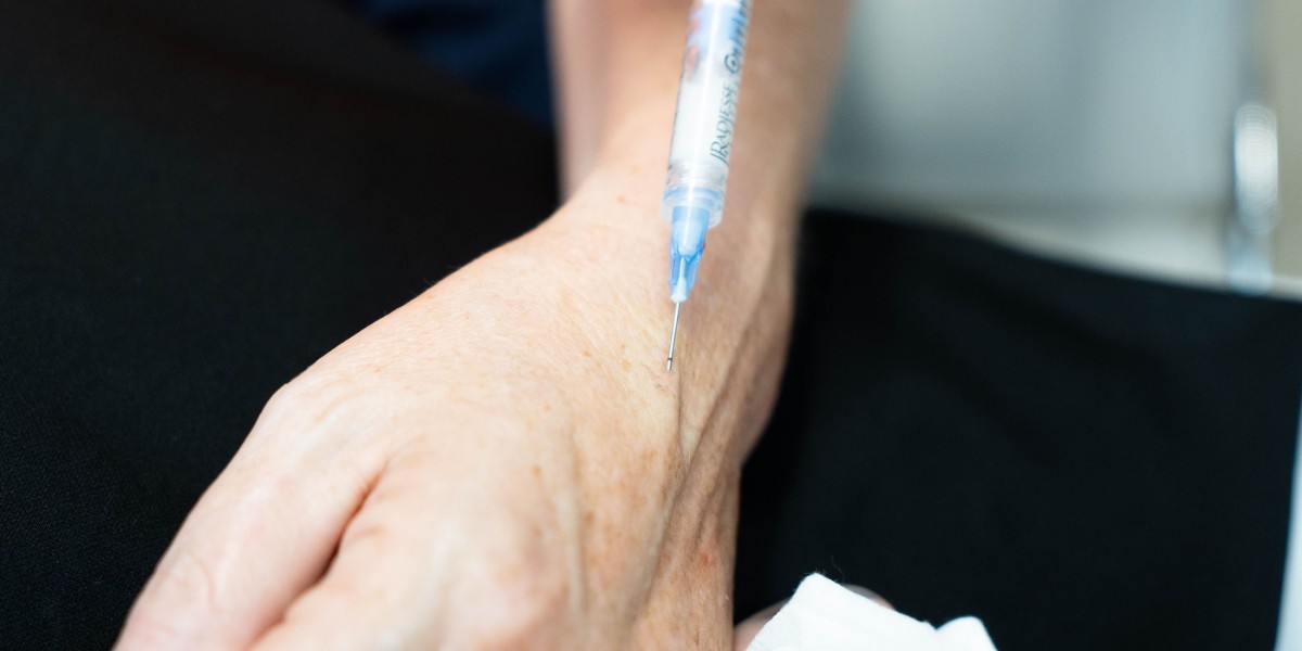Hand Rejuvenation in Islamabad: Laser vs Fillers