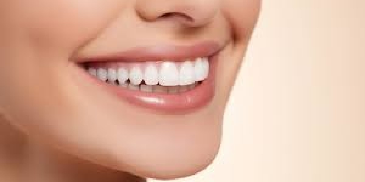 Top Benefits of Professional Teeth Whitening in Jaipur