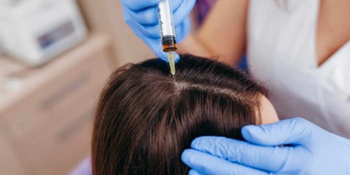 PRP for Thinning Edges in Islamabad: Treatment Tips