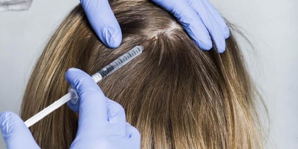 Is GFC Therapy Safe for Hair Loss?