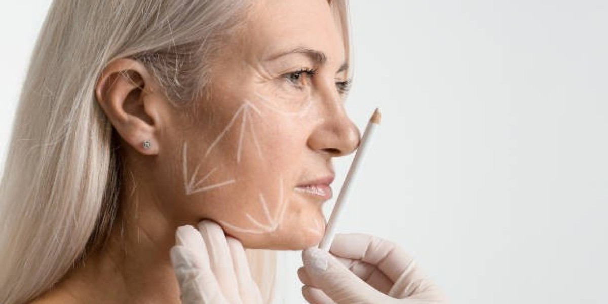Non-Surgical vs. Surgical Facelift — Which One is Better for You?