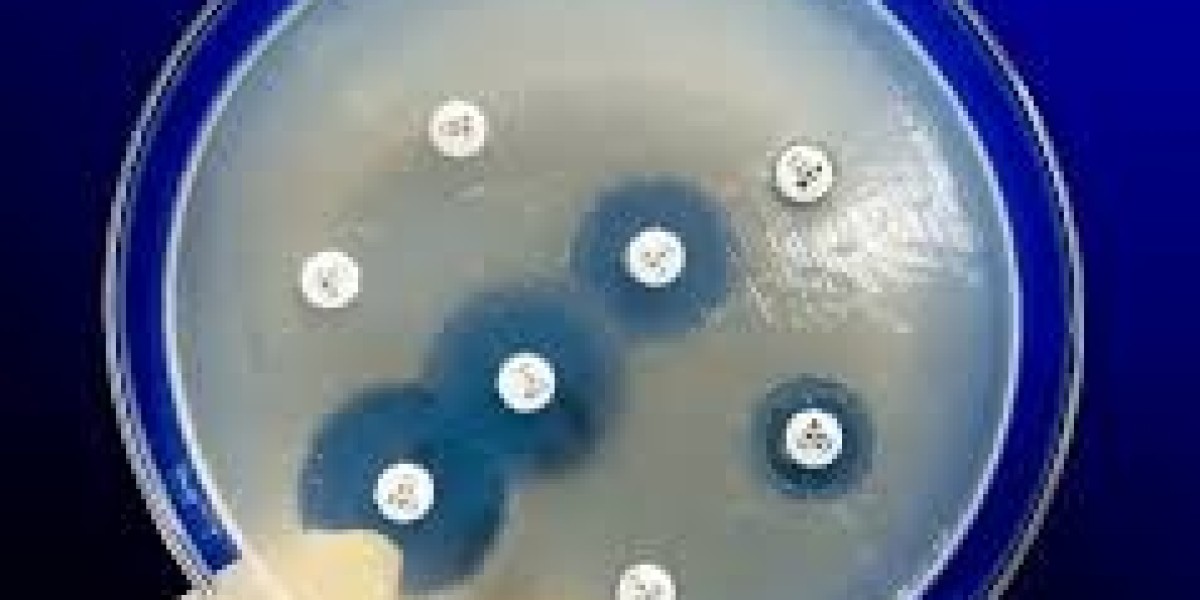 Antimicrobial Susceptibility Test Market Regional Revenue Analysis And Competitive Strategies Of Key Players