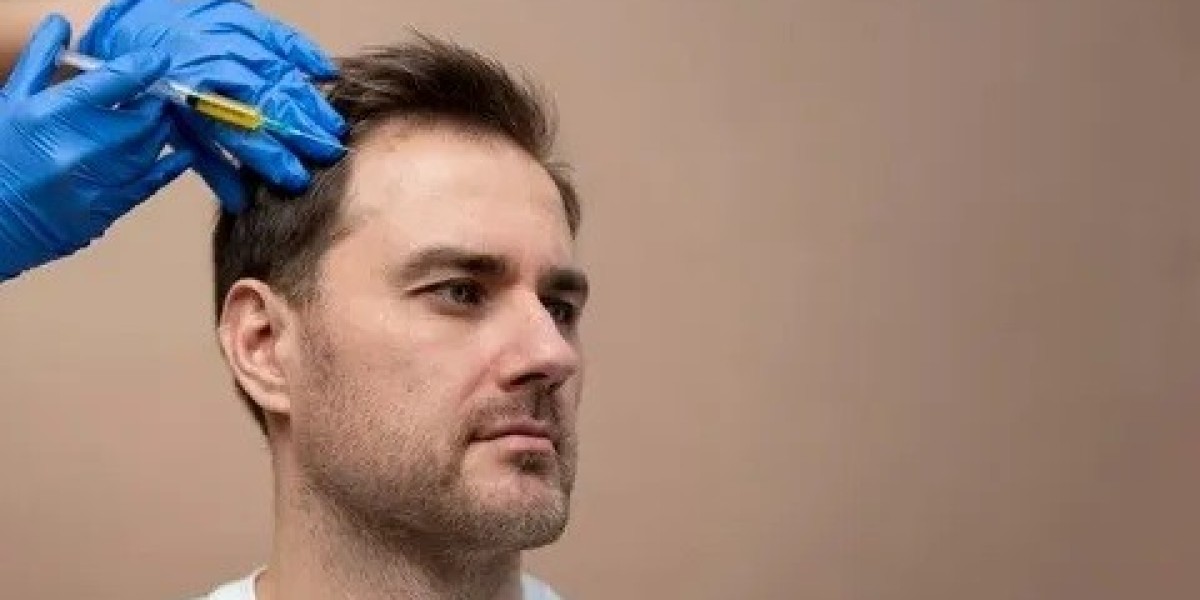 Hair Transplant in Islamabad: What Insurance Covers