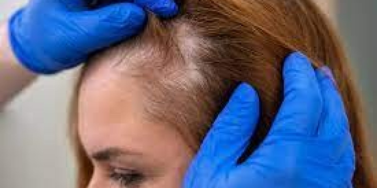 Non‑Strip vs Strip Methods: FUT vs FUE in Emirati Clinics in Dubai UAE At Glamorous ?