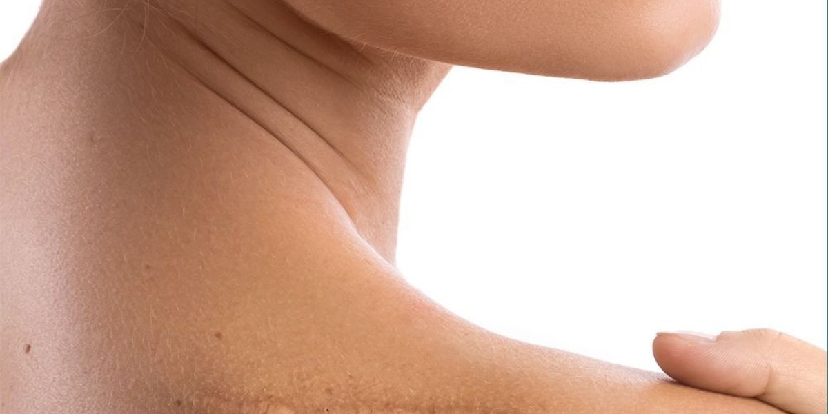 The Most Common Places Warts Appear