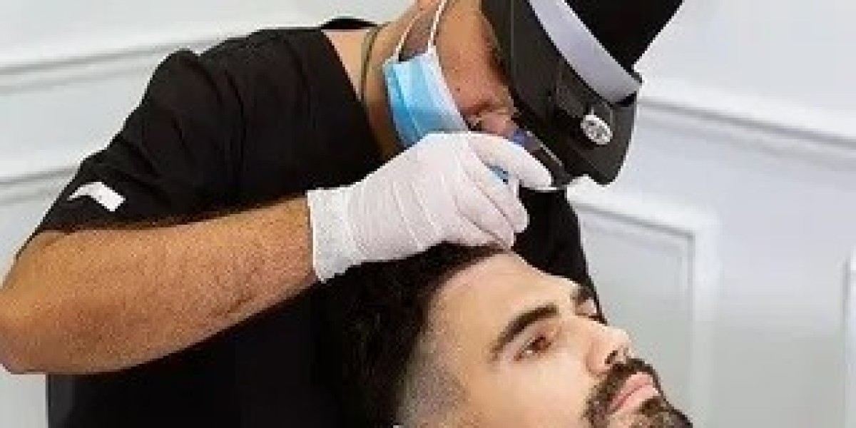 Understanding FUE and FUT Hair Transplant Methods in Islamabad