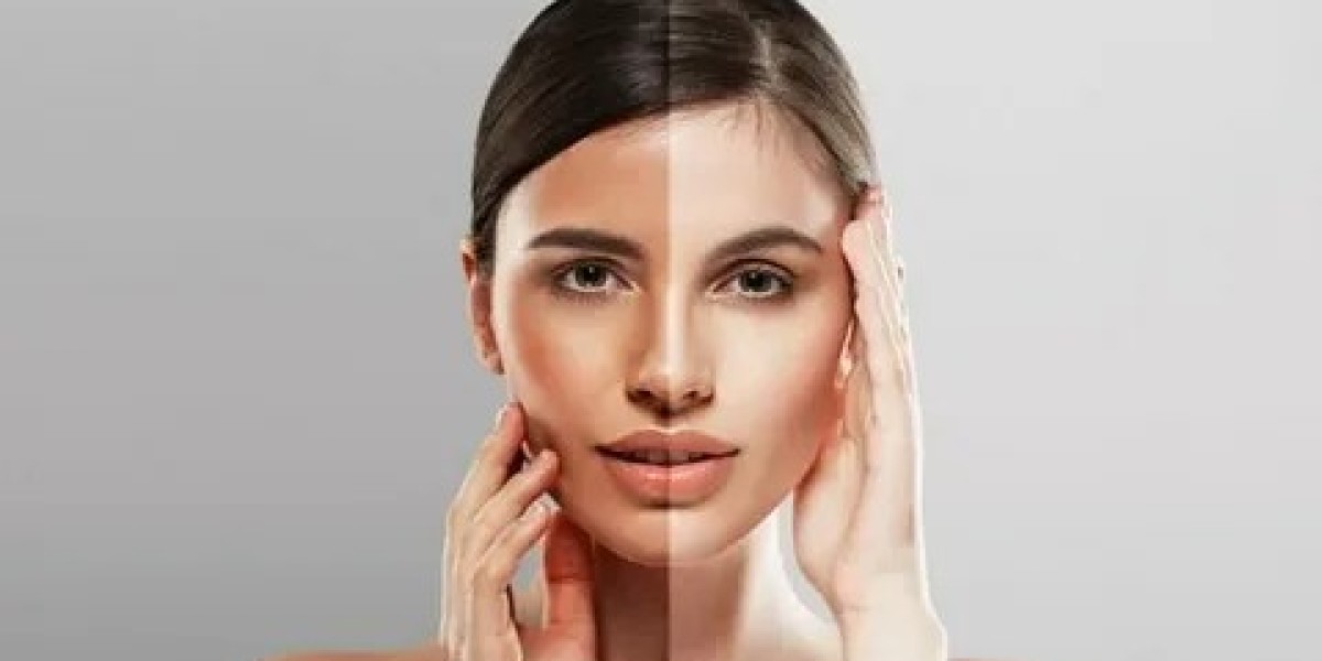 full body lightening treatment