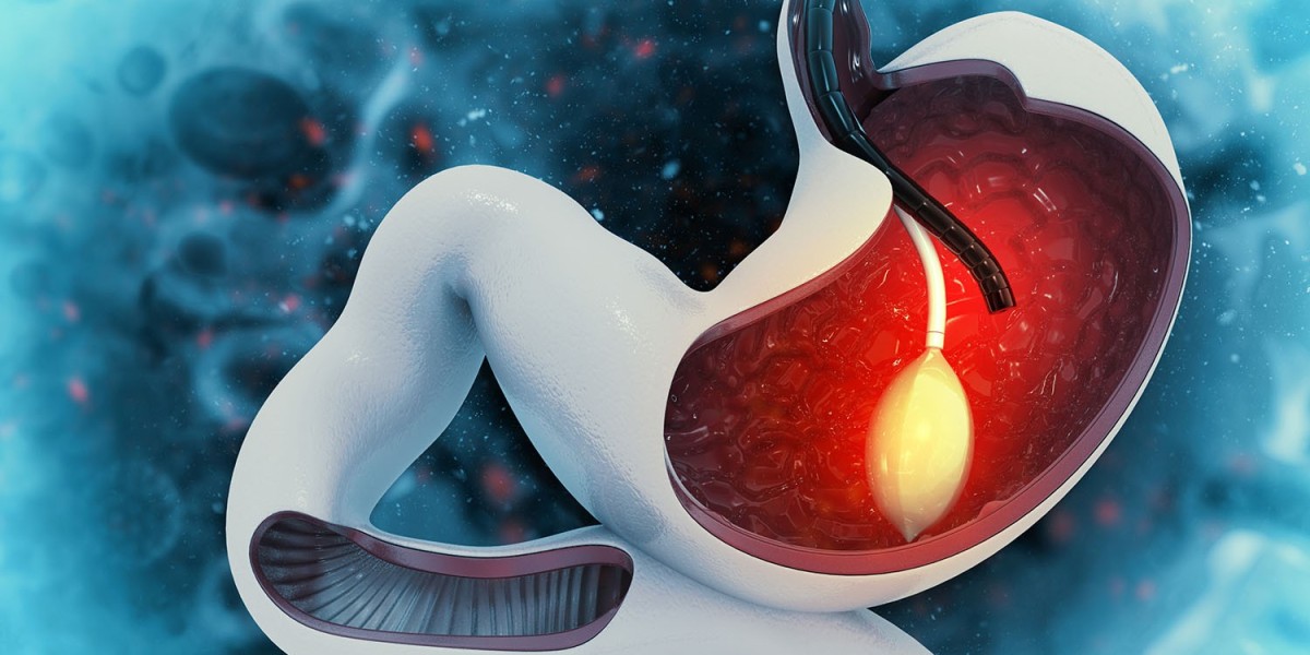 How Gastric Balloon Placement Differs from Other Weight Tools