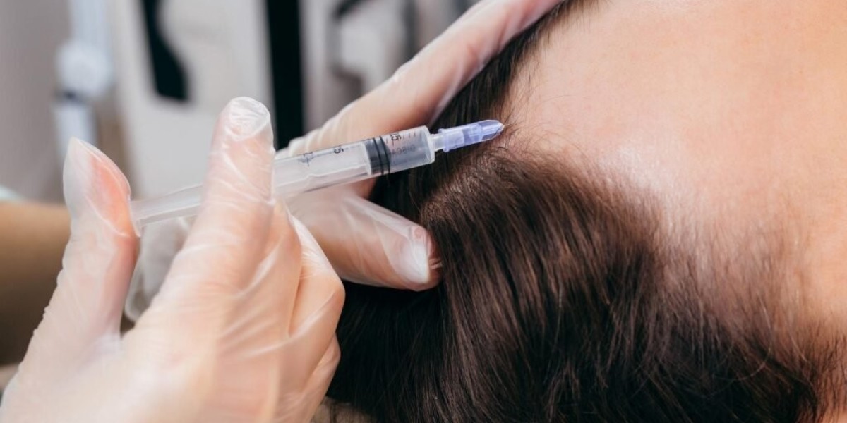 Achieve Strong Roots and Lush Hair With PRP Hair Treatment Cost